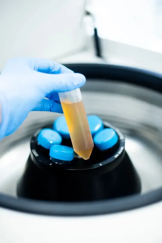 15mL High-Speed 17,000xg Centrifuge Tube, Red Screw Cap, Printed Graduations, STERILE